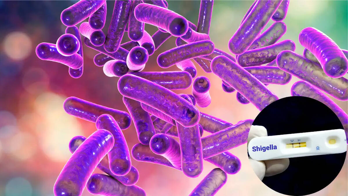 shigella