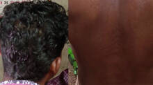 kerala